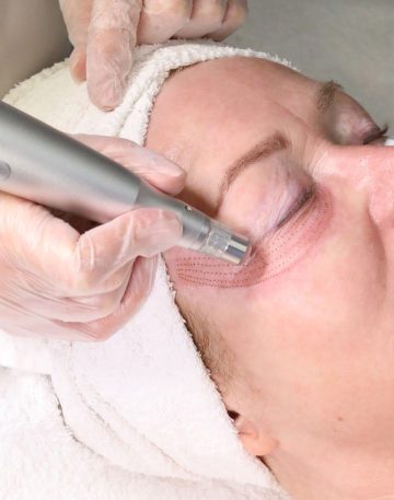 Phi-Ion-plasmalift-1-scaled